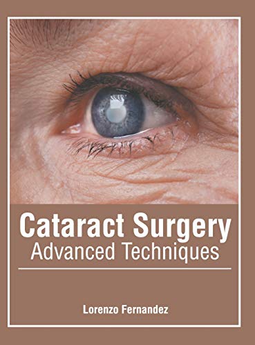 Cataract Surgery Advanced Techniques [Hardcover]