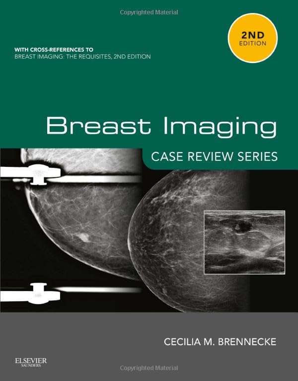 Breast Imaging Case Review Series [Paperback]