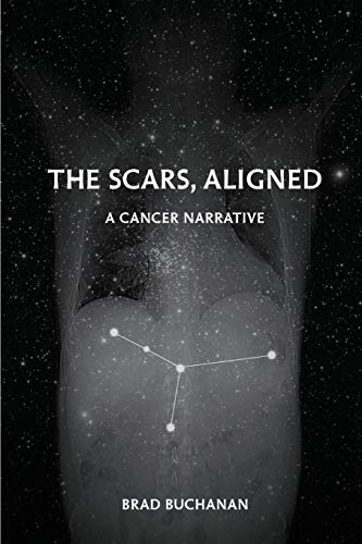 Scars, Aligned [Paperback]