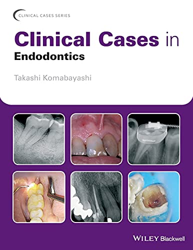 Clinical Cases in Endodontics [Paperback]
