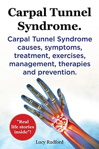 Carpal Tunnel Syndrome, Cts. Carpal Tunnel Syndrome Cts Causes, Symptoms, Treatm [Paperback]