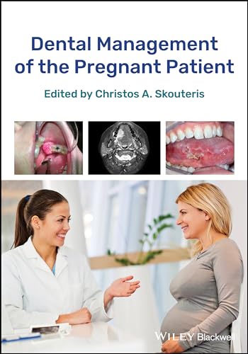 Dental Management of the Pregnant Patient [Paperback]