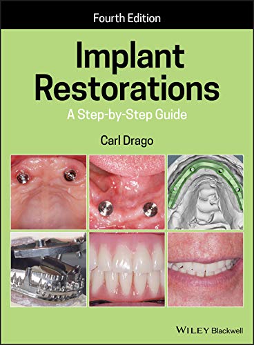 Implant Restorations A Step-by-Step Guide [Hardcover]