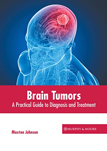 Brain Tumors A Practical Guide To Diagnosis And Treatment