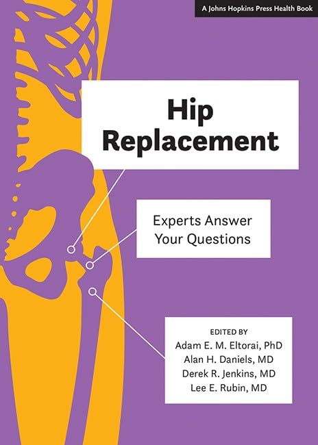 Hip Replacement Experts Answer Your Questions [Hardcover]