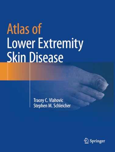 Atlas of Lower Extremity Skin Disease [Paperback]