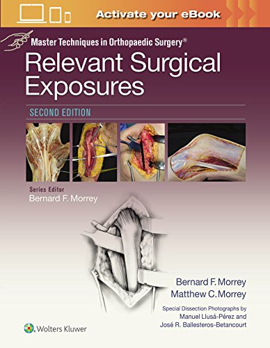 Master Techniques in Orthopaedic Surgery Relevant Surgical Exposures [Hardcover]