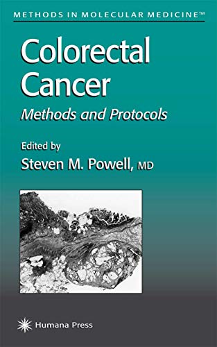 Colorectal Cancer Methods and Protocols [Hardcover]