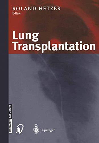 Lung Transplantation [Paperback]