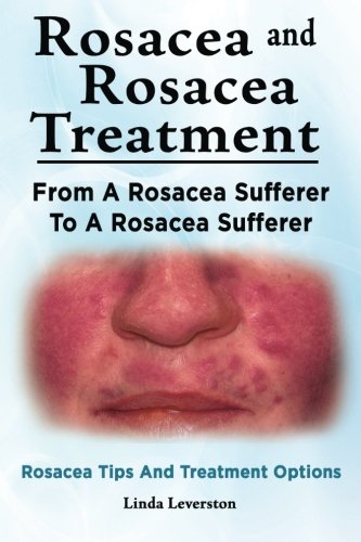 Rosacea And Rosacea Treatment. From A Rosacea Sufferer To A Rosacea Sufferer. Ro [Paperback]