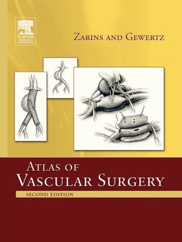 Atlas Of Vascular Surgery - Paperback Edition [Paperback]
