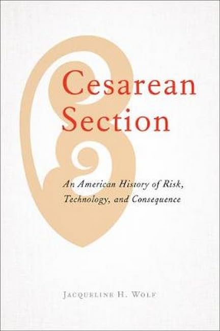 Cesarean Section An American History of Risk, Technology, and Consequence [Hardcover]