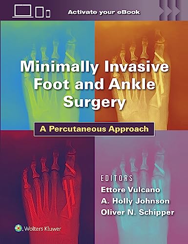 Minimally Invasive Foot and Ankle Surgery A Percutaneous Approach [Hardcover]