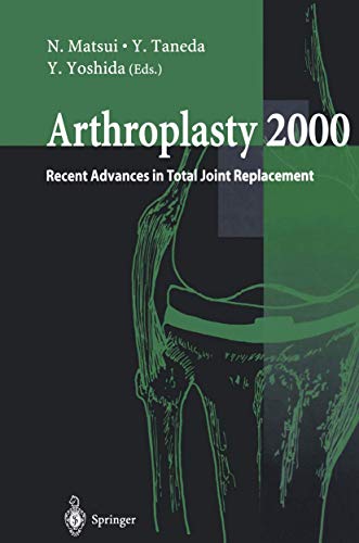 Arthroplasty 2000 Recent Advances in Total Joint Replacement [Paperback]