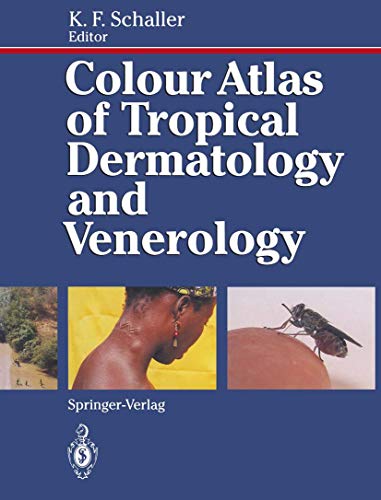 Colour Atlas of Tropical Dermatology and Venerology [Paperback]