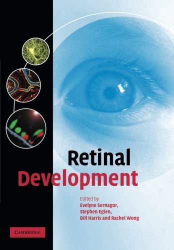 Retinal Development [Paperback]