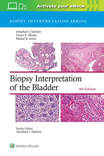 Biopsy Interpretation of the Bladder Print + eBook with Multimedia [Hardcover]