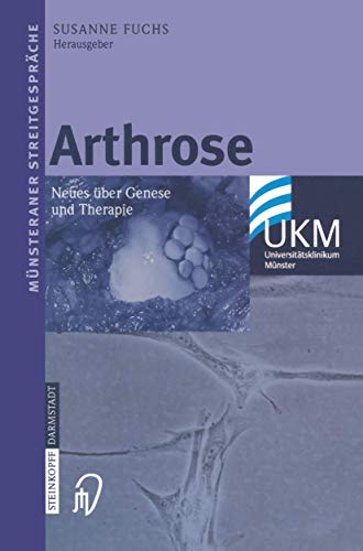Arthrose Neues ber Genese und Therapie [Paperback]