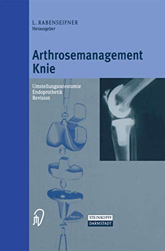 Arthrosemanagement Knie Umstellungsosteotomie  Endoprothetik  Revision [Hardcover]