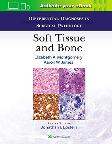 Differential Diagnoses in Surgical Pathology Soft Tissue and Bone [Hardcover]