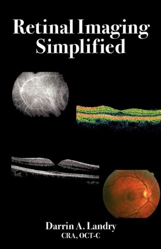 Retinal Imaging Simplified [Paperback]
