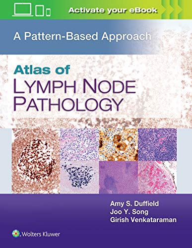 Atlas of Lymph Node Pathology A Pattern Based Approach [Hardcover]