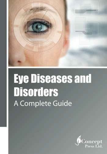 Eye Diseases And Disorders A Complete Guide [Paperback]