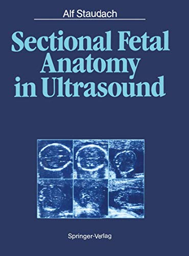Sectional Fetal Anatomy in Ultrasound [Paperback]