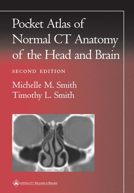 Pocket Atlas of Normal CT Anatomy of the Head and Brain [Paperback]
