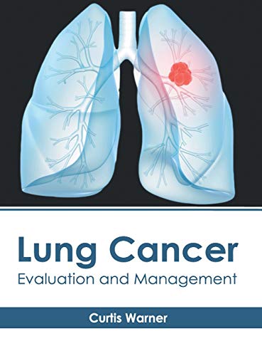 Lung Cancer Evaluation and Management [Hardcover]