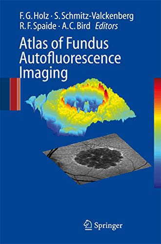 Atlas of Fundus Autofluorescence Imaging [Paperback]