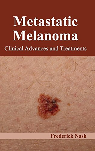 Metastatic Melanoma Clinical Advances And Treatments [Hardcover]