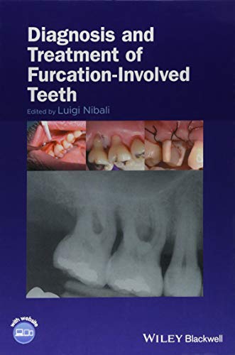 Diagnosis and Treatment of Furcation-Involved Teeth [Hardcover]
