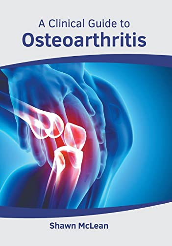 A Clinical Guide to Osteoarthritis [Hardcover]