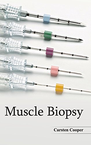 Muscle Biopsy [Hardcover]