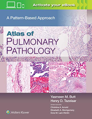 Atlas of Pulmonary Pathology A Pattern Based Approach [Hardcover]
