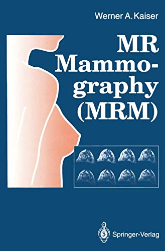 MR Mammography (MRM) [Paperback]