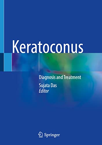 Keratoconus Diagnosis and Treatment [Hardcover]