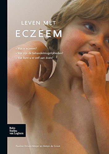 Leven met eczeem [Paperback]