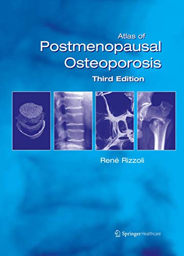 Atlas of Postmenopausal Osteoporosis Third Edition [Paperback]