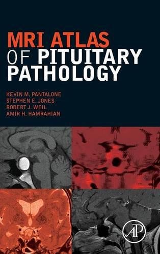 MRI Atlas of Pituitary Pathology [Hardcover]