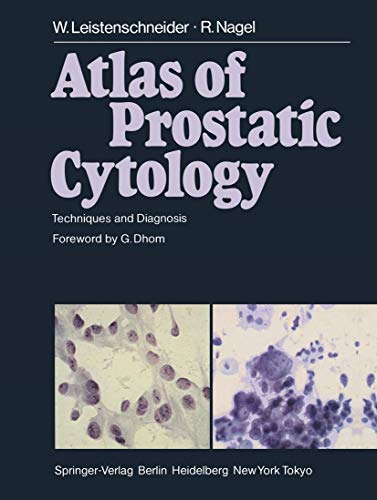 Atlas of Prostatic Cytology Techniques and Diagnosis [Paperback]