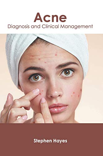 Acne Diagnosis and Clinical Management [Hardcover]