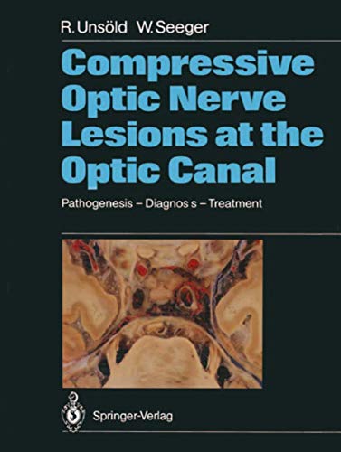 Compressive Optic Nerve Lesions at the Optic Canal Pathogenesis  Diagnosis  T [Paperback]