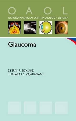 Glaucoma [Paperback]