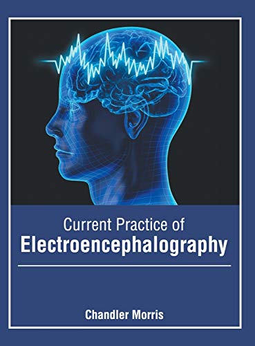 Current Practice of Electroencephalography [Hardcover]
