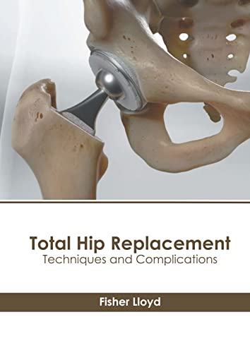 Total Hip Replacement Techniques And Complications