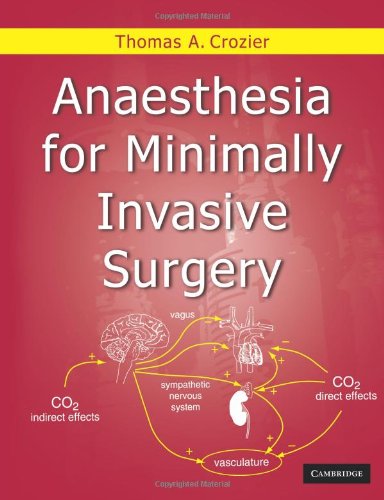 Anaesthesia for Minimally Invasive Surgery [Paperback]