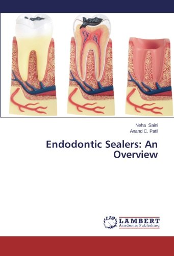 Endodontic Sealers An Overview [Paperback]