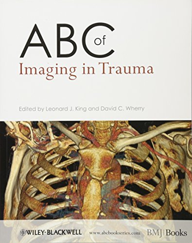 ABC of Imaging in Trauma [Paperback]
